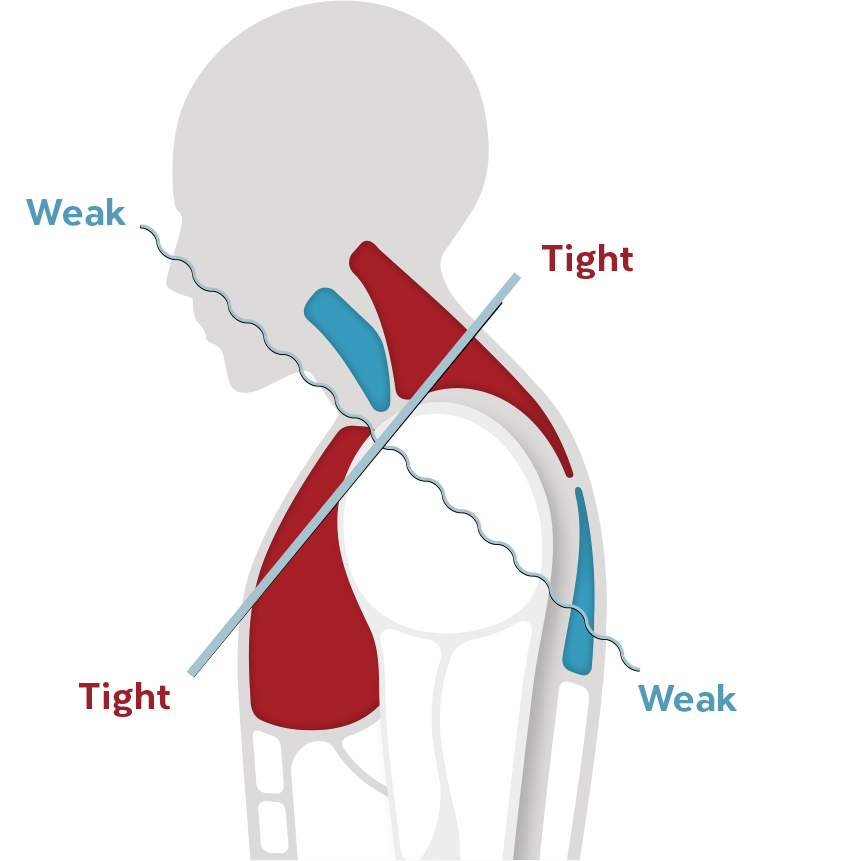 Thoracic Decompression