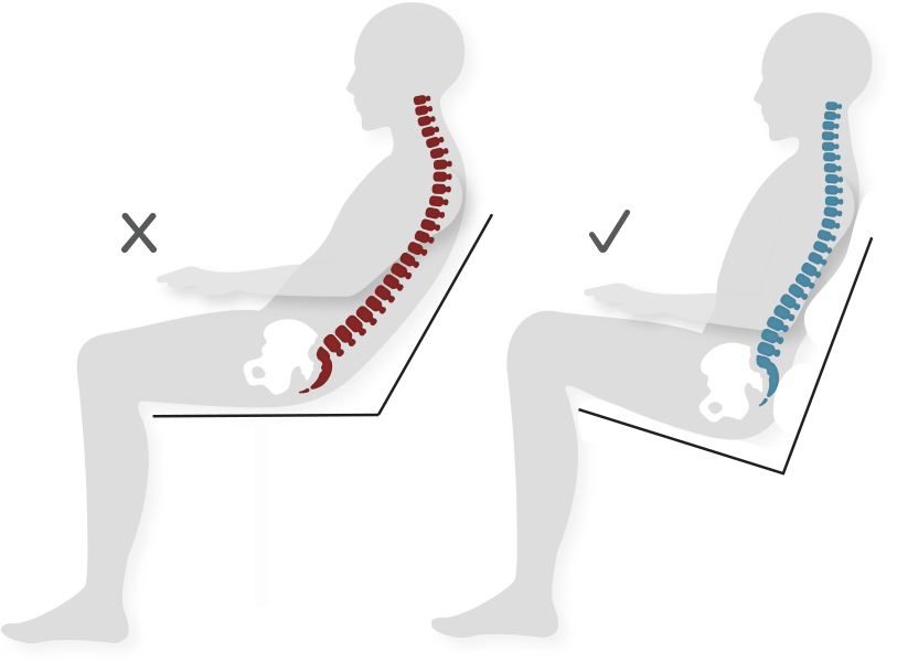 body-posture-types-explained-how-to-improve-posture-for-healthy-back